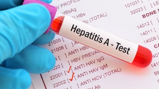 Министерството на здравеопазването информира общопрактикуващите лекари и специалистите в България